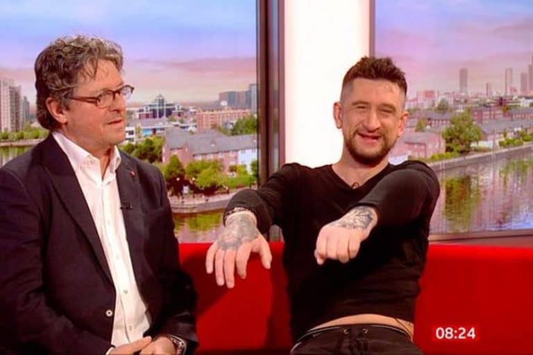 Scaffolder Receives Life-Changing Double Hand Transplant After Devastating Accident